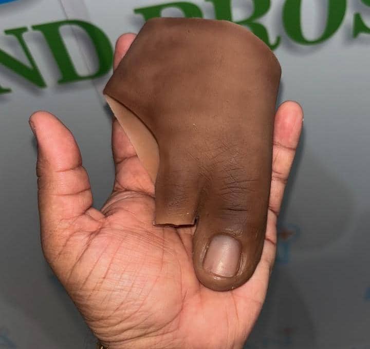 Patient rehabilitation and training area