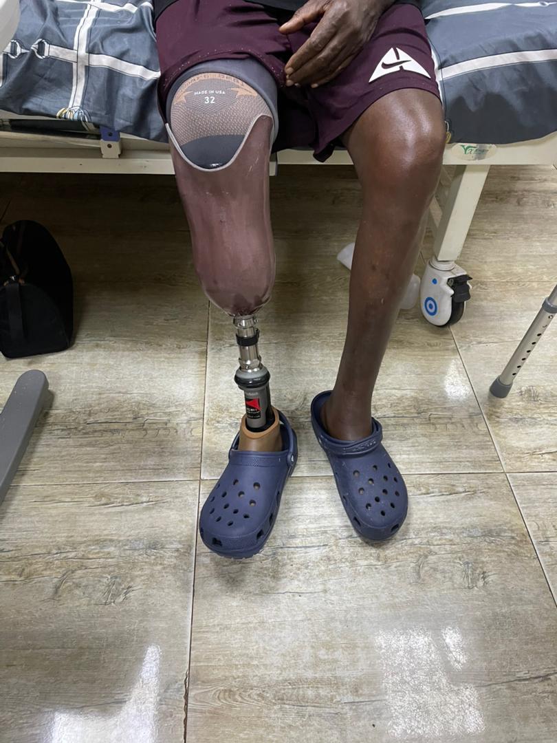 Modern prosthetic fitting room